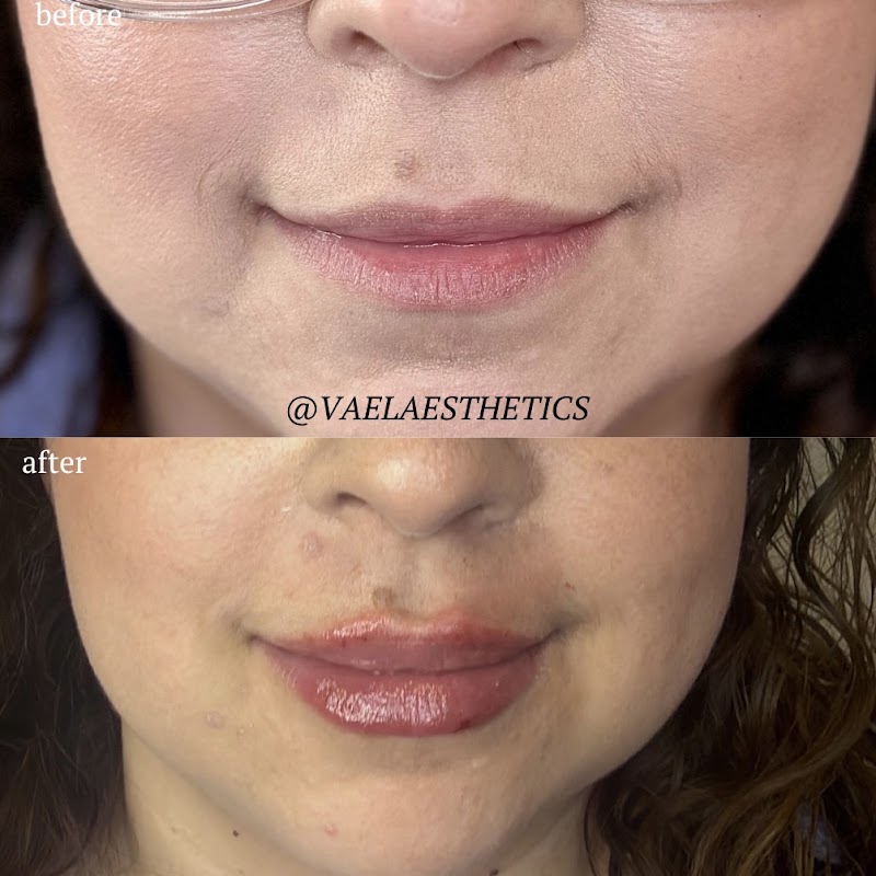 VAEL AESTHETICS, spa in Woodland, CA, photo 2 of 7