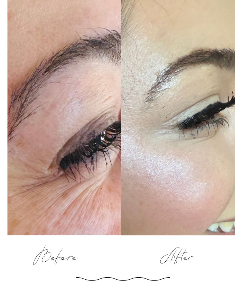 VAEL AESTHETICS, spa in Woodland, CA, photo 5 of 7