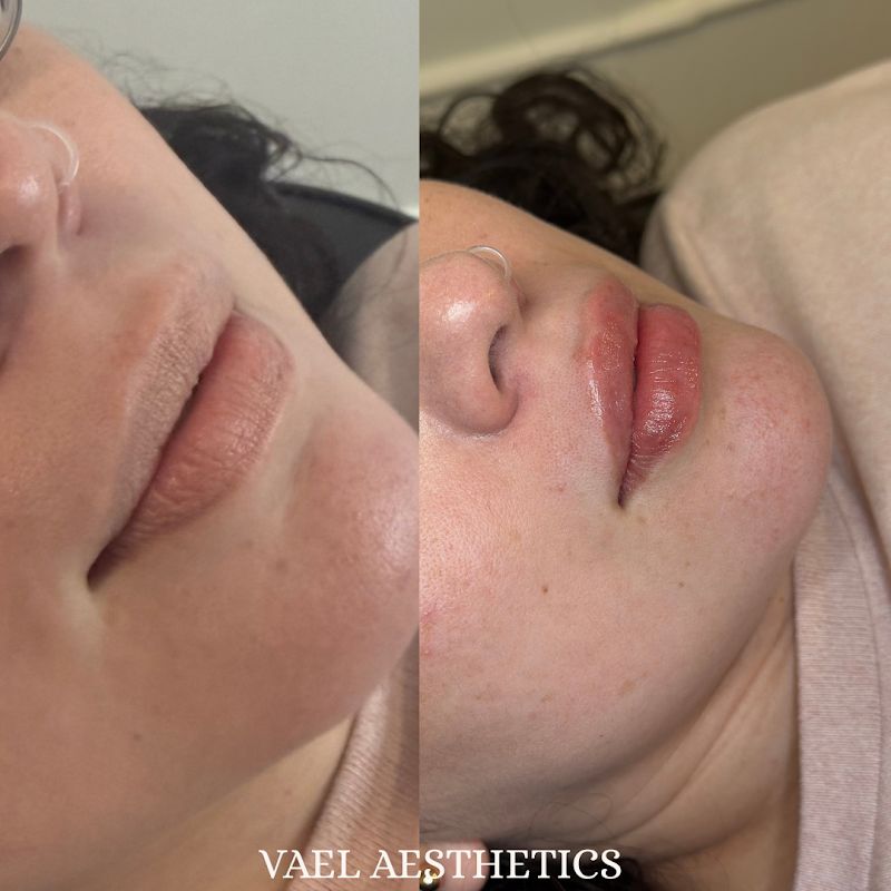 VAEL AESTHETICS, spa in Woodland, CA, photo 6 of 7